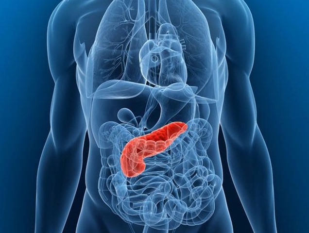 Tumore del pancreas, forte crescita dei casi